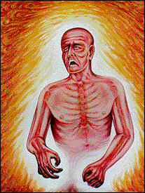 Kevorkian painting entitled Fever