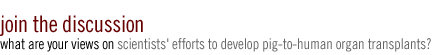 join the discussion: What are your views on scientists efforts to develop pig-to-human organ transplants?