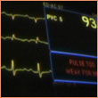 photo of an ekg