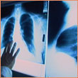 photo of a chest xray